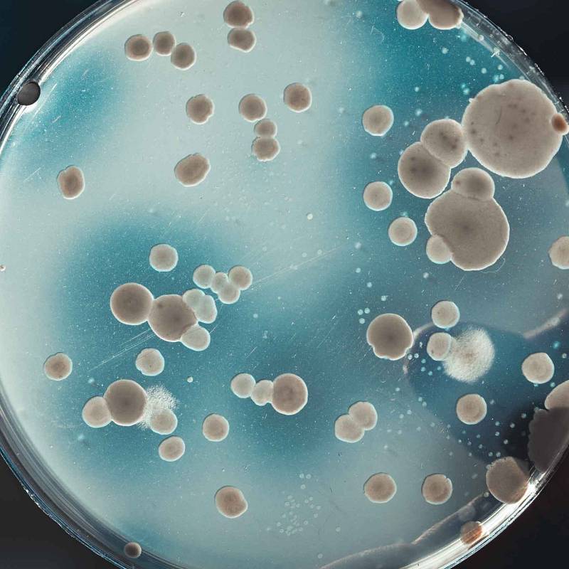 Petrischale mit wachsenden Bakterien- oder Pilzkulturen im Labor.