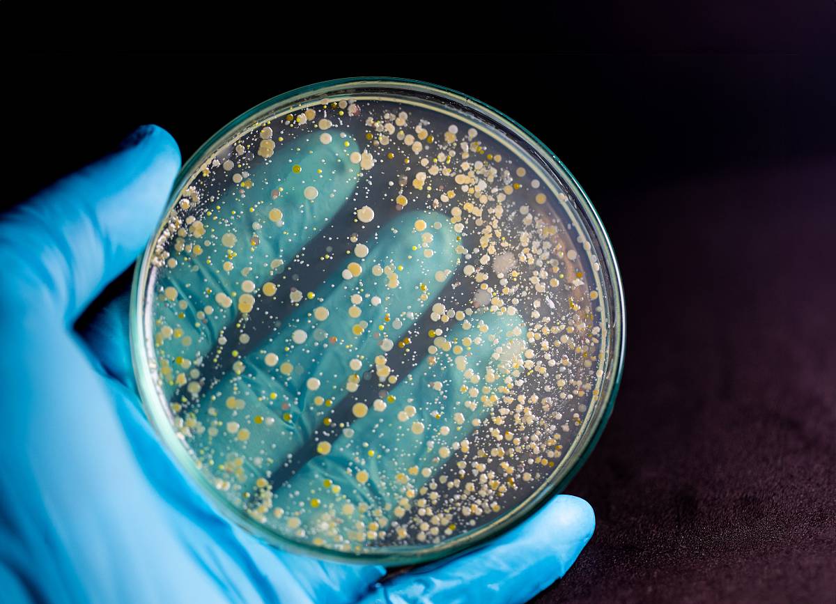 Nahaufnahme einer Petrischale mit Schimmelkulturen, gehalten von einer Hand in blauer Schutzhandschuhen, zur Analyse im Labor.