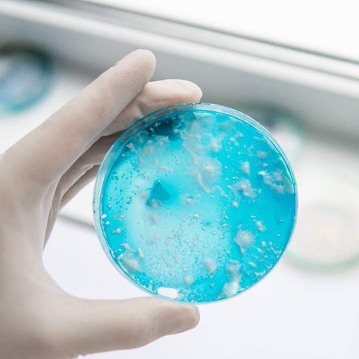 Laborprobe in einer Petrischale mit blauer Nährlösung, gehalten von einer Person mit Einweghandschuh.