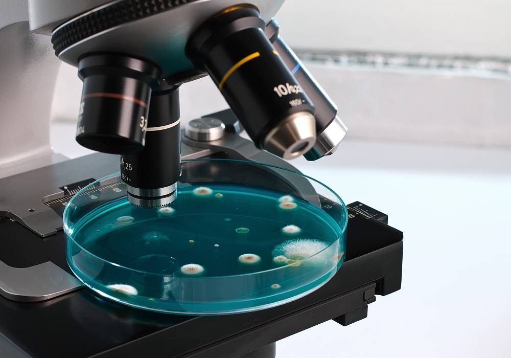 Mikroskopische Analyse von Schimmelpilzsporen in einer Petrischale zur Untersuchung von Gebäudeschadstoffen im Labor.