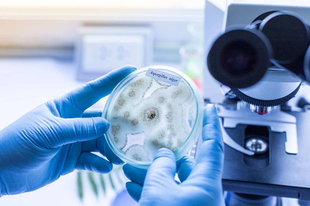 Laboranalyse einer Schimmelprobe des Pilzes Aspergillus niger unter dem Mikroskop