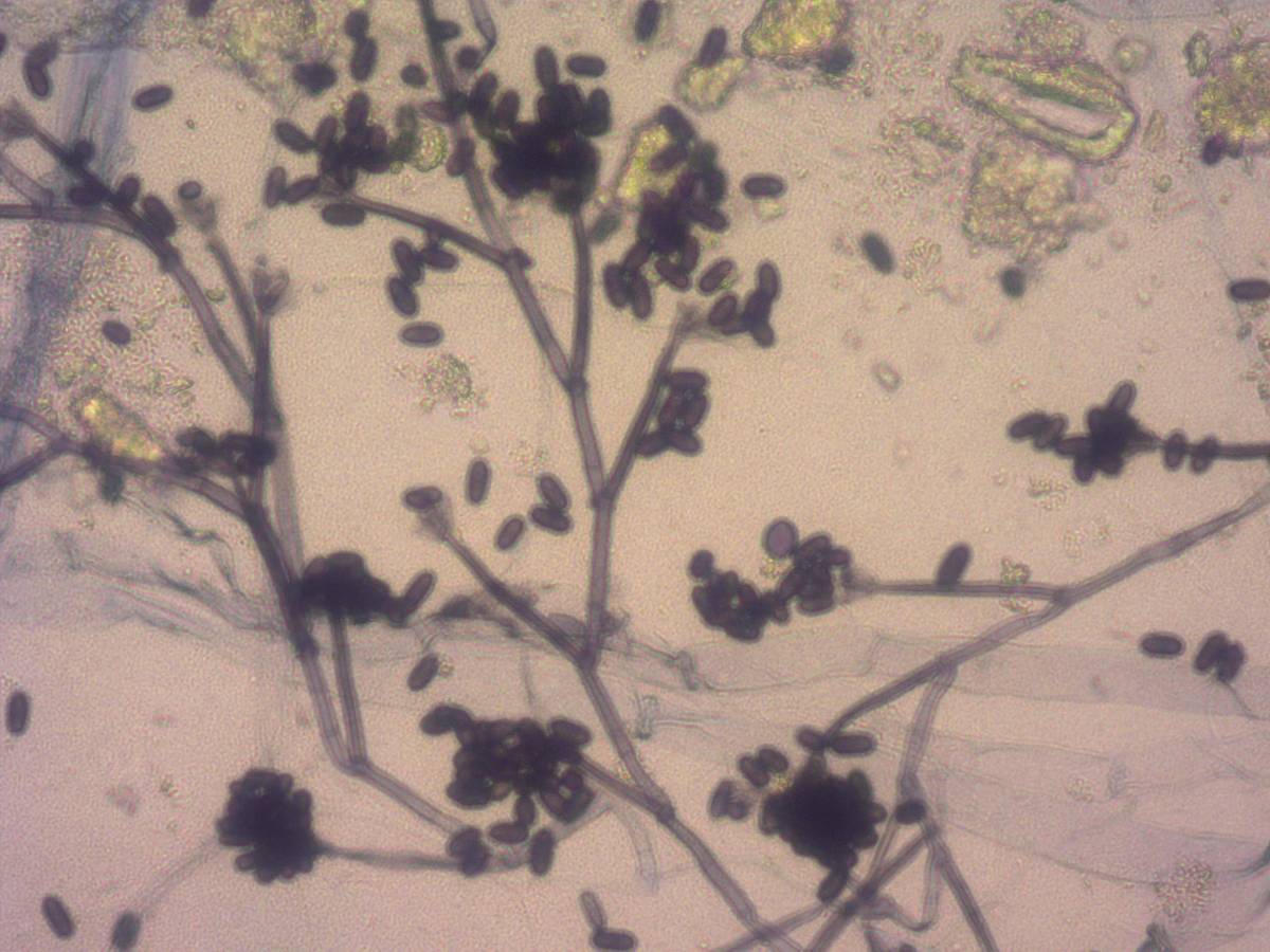 Alt-Text: Mikroskopische Aufnahme von Schimmelsporen und Hyphen, wie sie bei der mykologischen Analyse im Labor sichtbar werden.