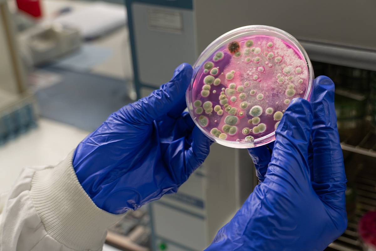 Laboranalyse von Schimmelproben: Untersuchung von Pilzkolonien in einer Petrischale durch Fachpersonal mit Schutzhandschuhen.