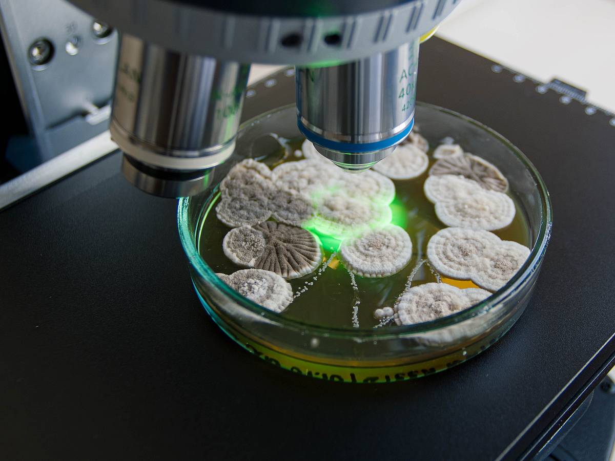 Mikroskopische Untersuchung von Schimmelpilzkolonien in einer Petrischale zur Analyse von Innenraumschimmel.