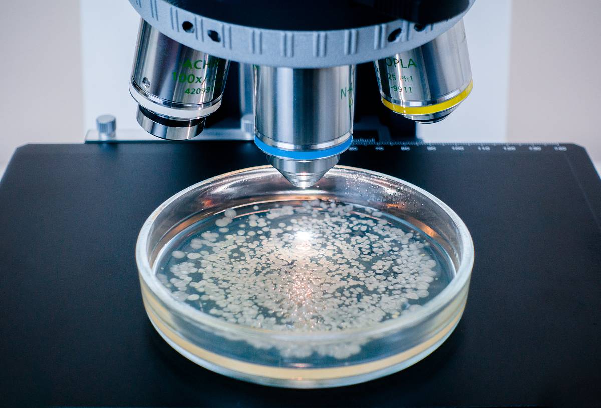 Petrischale mit Schimmel liegt unter einem Mikroskop.